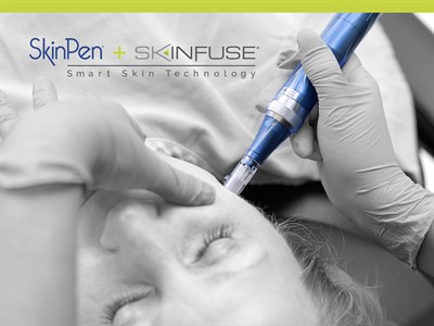 SkinPen Microneedling Procedure Photo
